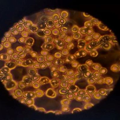 Organoid and Tissues: Cellular Differentiation with&nbsp;Microrobots