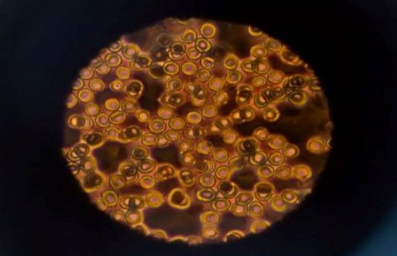 Organoid and Tissues: Cellular Differentiation with&nbsp;Microrobots
